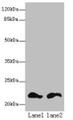 Western blot; All lanes: FKBP11 antibody at 6µg/ml; Lane 1: Mouse spleen tissue; Lane 2: Mouse liver tissue; Secondary; Goat polyclonal to rabbit IgG at 1/10000 dilution; Predicted band size: 23, 16 kDa; Observed band size: 23 kDa;