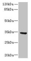 Western blot; All lanes: SLC25A18 antibody at 0.3µg/ml + U87 whole cell lysate; Secondary; Goat polyclonal to rabbit IgG at 1/10000 dilution; Predicted band size: 34 kDa; Observed band size: 34 kDa;