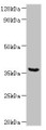 Western blot; All lanes: WD repeat-containing protein 54 at 2µg/ml + Mouse stomach tissue; Secondary; Goat polyclonal to rabbit IgG at 1/10000 dilution; Predicted band size: 36 kDa; Observed band size: 36 kDa;