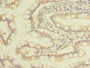 Immunohistochemistry of paraffin-embedded human small intestine tissue using CAC09862 at dilution of 1:100