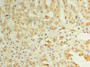 Immunohistochemistry of paraffin-embedded human adrenal gland tissue using CAC09862 at dilution of 1: 100