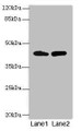 Western blot; All lanes: NMUR1 antibody at 2µg/ml; Lane 1: Mouse liver tissue; Lane 2: Mouse kidney tissue; Secondary; Goat polyclonal to rabbit IgG at 1/10000 dilution; Predicted band size: 47 kDa; Observed band size: 47 kDa;