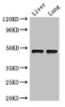 Western Blot; Positive WB detected in: Mouse liver tissue, Mouse lung tissue; All lanes: SEC14L3 antibody at 3µg/ml; Secondary; Goat polyclonal to rabbit IgG at 1/50000 dilution; Predicted band size: 47 kDa; Observed band size: 47 kDa;