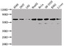 Western Blot; Positive WB detected in: A549 whole cell lysate, 293T whole cell lysate, L02 whole cell lysate, HepG2 whole cell lysate, Hela whole cell lysate, SH-SY5Y whole cell lysate, K562 whole cell lysate, Mouse liver tissue; All lanes: SLC23A1 antibody at 1:2000; Secondary; Goat polyclonal to rabbit IgG at 1/50000 dilution; Predicted band size: 65, 66, 29 kDa; Observed band size: 80 kDa;