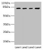Western blot; All lanes: DHX35 antibody at 12µg/ml; Lane 1: Mouse kidney tissue; Lane 2: Mouse liver tissue; Lane 3: K562 whole cell lysate; Lane 4: Hela whole cell lysate; Secondary; Goat polyclonal to rabbit IgG at 1/10000 dilution; Predicted band size: 79, 76 kDa; Observed band size: 79 kDa