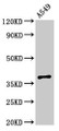 Western Blot; , Positive WB detected in: A549 whole cell lysate; , All lanes: PAQR5 antibody at 2.5µg/ml; , Secondary; , Goat polyclonal to rabbit IgG at 1/50000 dilution; , Predicted band size: 39 kDa; , Observed band size: 39 kDa;