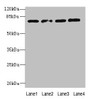 Western blot; All lanes: TBC1D14 antibody at 4µg/ml; Lane 1: K562 whole cell lysate; Lane 2: U87 whole cell lysate; Lane 3: A549 whole cell lysate; Lane 4: HepG2 whole cell lysate; Secondary; Goat polyclonal to rabbit IgG at 1/10000 dilution; Predicted band size: 79, 48 kDa; Observed band size: 79 kDa;