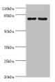 Western blot; All lanes: MTRR antibody at 2µg/ml; Lane 1: PC-3 whole cell lysate; Lane 2: HepG2 whole cell lysate; Secondary; Goat polyclonal to rabbit IgG at 1/10000 dilution; Predicted band size: 81, 78, 7 kDa; Observed band size: 81 kDa;