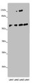 Western blot; All lanes: ANGPTL2 antibody at 8µg/ml; Lane 1: Mouse spleen tissue; Lane 2: K562 whole cell lysate; Lane 3: Hela whole cell lysate; Lane 4: A549 whole cell lysate; Secondary; Goat polyclonal to rabbit IgG at 1/10000 dilution; Predicted band size: 58, 23 kDa; Observed band size: 58 kDa;