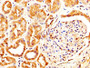 IHC image diluted at 1:600 and staining in paraffin-embedded human kidney tissue performed on a Leica BondTM system. After dewaxing and hydration, antigen retrieval was mediated by high pressure in a citrate buffer (pH 6.0). Section was blocked with 10% normal goat serum 30min at RT. Then primary antibody (1% BSA) was incubated at 4°C overnight. The primary is detected by a biotinylated secondary antibody and visualized using an HRP conjugated SP system.