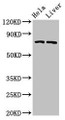 Western Blot; Positive WB detected in: Hela whole cell lysate, Rat liver tissue; All lanes: ACSL5 antibody at 3µg/ml; Secondary; Goat polyclonal to rabbit IgG at 1/50000 dilution; Predicted band size: 76, 83, 74, kDa; Observed band size: 76 kDa