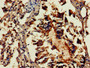 Immunohistochemistry of paraffin-embedded human lung tissue using CAC09951 at dilution of 1:100