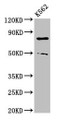 Western Blot; Positive WB detected in: K562 whole cell lysate; All lanes: PADI2 antibody at 3µg/ml; Secondary; Goat polyclonal to rabbit IgG at 1/50000 dilution; Predicted band size: 76, 50 kDa; Observed band size: 76, 50 kDa