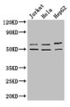 Western Blot; Positive WB detected in: Jurkat whole cell lysate, Hela whole cell lysate, HepG2 whole cell lysate; All lanes: YTHDF2 antibody at 2.7µg/ml; Secondary; Goat polyclonal to rabbit IgG at 1/50000 dilution; Predicted band size: 63, 57 kDa; Observed band size: 63, 50 kDa;