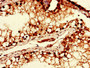 Immunohistochemistry of paraffin-embedded human testis tissue using CAC09978 at dilution of 1:100