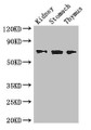 Western Blot; Positive WB detected in: Mouse kidney tissue, Mouse stomach tissue, Mouse thymus tissue; All lanes: COL4A3BP antibody at 3.4µg/ml; Secondary; Goat polyclonal to rabbit IgG at 1/50000 dilution; Predicted band size: 71, 69, 84 kDa; Observed band size: 71 kDa;