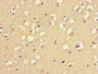 Immunohistochemistry of paraffin-embedded human brain tissue using CAC09995 at dilution of 1:100