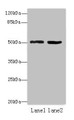 Western blot; All lanes: ZBTB32 antibody at 4µg/ml; Lane 1: Mouse brain tissue; Lane 2: Jurkat whole cell lysate; Secondary; Goat polyclonal to rabbit IgG at 1/10000 dilution; Predicted band size: 53 kDa; Observed band size: 53 kDa;