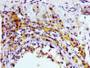 IHC image diluted at 1:100 and staining in paraffin-embedded human testis tissue performed on a Leica BondTM system. After dewaxing and hydration, antigen retrieval was mediated by high pressure in a citrate buffer (pH 6.0). Section was blocked with 10% normal goat serum 30min at RT. Then primary antibody (1% BSA) was incubated at 4°C overnight. The primary is detected by a biotinylated secondary antibody and visualized using an HRP conjugated SP system.