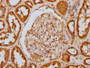 IHC image diluted at 1:100 and staining in paraffin-embedded human kidney tissue performed on a Leica BondTM system. After dewaxing and hydration, antigen retrieval was mediated by high pressure in a citrate buffer (pH 6.0). Section was blocked with 10% normal goat serum 30min at RT. Then primary antibody (1% BSA) was incubated at 4? overnight. The primary is detected by a biotinylated secondary antibody and visualized using an HRP conjugated SP system.