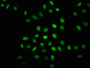 Immunofluorescence staining of Hela cells(treated with 50mM Calyculin A for 30min) with CAC10026 at 1:100,counter-stained with DAPI. The cells were fixed in 4% formaldehyde, permeabilized using 0.2% Triton X-100 and blocked in 10% normal Goat Serum. The cells were then incubated with the antibody overnight at 4?. The secondary antibody was Alexa Fluor 488-congugated AffiniPure Goat Anti-Rabbit IgG (H+L).