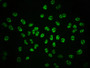 Immunofluorescence staining of Hela cells with CAC10044 at 1:100,counter-stained with DAPI. The cells were fixed in 4% formaldehyde, permeabilized using 0.2% Triton X-100 and blocked in 10% normal Goat Serum. The cells were then incubated with the antibody overnight at 4?. The secondary antibody was Alexa Fluor 488-congugated AffiniPure Goat Anti-Rabbit IgG (H+L).