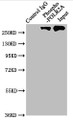 Immunoprecipitating Phospho-POLR2A in Hela whole cell lysate; , Lane 1: Rabbit control IgG(1µg)instead in Hela whole cell lysate., For western blotting,a HRP-conjugated Protein G antibody was used as the secondary antibody (1/2000); , Lane 2: CAC10044(3µg)+ Hela whole cell lysate(1mg); , Lane 3: Hela whole cell lysate (20µg);