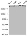 Western Blot; Positive WB detected in: Hela whole cell lysate, A549 whole cell lysate, PC3 whole cell lysate, HepG2 whole cell lysate; All lanes: ATM antibody at 2.05µg/ml; Secondary; Goat polyclonal to rabbit IgG at 1/50000 dilution; Predicted band size: 350 KDa; Observed band size: 350 KDa;