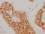 IHC image diluted at 1:205 and staining in paraffin-embedded human testis tissue performed on a Leica BondTM system. After dewaxing and hydration, antigen retrieval was mediated by high pressure in a citrate buffer (pH 6.0). Section was blocked with 10% normal goat serum 30min at RT. Then primary antibody (1% BSA) was incubated at 4? overnight. The primary is detected by a biotinylated secondary antibody and visualized using an HRP conjugated SP system.