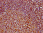 IHC image diluted at 1:73.125 and staining in paraffin-embedded human tonsil tissue performed on a Leica BondTM system. After dewaxing and hydration, antigen retrieval was mediated by high pressure in a citrate buffer (pH 6.0). Section was blocked with 10% normal goat serum 30min at RT. Then primary antibody (1% BSA) was incubated at 4? overnight. The primary is detected by a biotinylated secondary antibody and visualized using an HRP conjugated SP system.