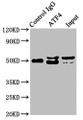 Immunoprecipitating ATF4 in Hela whole cell lysate; , Lane 1: Rabbit control IgG instead in Hela whole cell lysate., For western blotting, a HRP-conjugated Protein G antibody was used as the secondary antibody (1/2000); , Lane 2: CAC10071 (3µg) + Hela whole cell lysate (500µg); , Lane 3: Hela whole cell lysate (20µg);