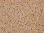 IHC image diluted at 1:81 and staining in paraffin-embedded human adrenal gland tissue performed on a Leica BondTM system. After dewaxing and hydration, antigen retrieval was mediated by high pressure in a citrate buffer (pH 6.0). Section was blocked with 10% normal goat serum 30min at RT. Then primary antibody (1% BSA) was incubated at 4? overnight. The primary is detected by a biotinylated secondary antibody and visualized using an HRP conjugated SP system.
