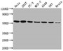 Western Blot; Positive WB detected in: Hela whole cell lysate, 293T whole cell lysate, PC-3 whole cell lysate, MCF-7 whole cell lysate, A549 whole cell lysate, U87 whole cell lysate, Brain tissue; All lanes: KLF4 antibody at 1:1500; Secondary; Goat polyclonal to rabbit IgG at 1/50000 dilution; Predicted band size: 55, 52, 46, 13, 7 kDa; Observed band size: 55 kDa;