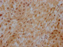 IHC image diluted at 1:100 and staining in paraffin-embedded human placenta tissue performed on a Leica BondTM system. After dewaxing and hydration, antigen retrieval was mediated by high pressure in a citrate buffer (pH 6.0). Section was blocked with 10% normal goat serum 30min at RT. Then primary antibody (1% BSA) was incubated at 4? overnight. The primary is detected by a Goat anti-rabbit IgG polymer labeled by HRP and visualized using 0.05% DAB.