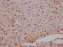 IHC image diluted at 1:100 and staining in paraffin-embedded human heart tissue performed on a Leica BondTM system. After dewaxing and hydration, antigen retrieval was mediated by high pressure in a citrate buffer (pH 6.0). Section was blocked with 10% normal goat serum 30min at RT. Then primary antibody (1% BSA) was incubated at 4? overnight. The primary is detected by a Goat anti-rabbit IgG polymer labeled by HRP and visualized using 0.05% DAB.