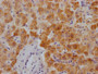 IHC image diluted at 1:100 and staining in paraffin-embedded human liver tissue performed on a Leica BondTM system. After dewaxing and hydration, antigen retrieval was mediated by high pressure in a citrate buffer (pH 6.0). Section was blocked with 10% normal goat serum 30min at RT. Then primary antibody (1% BSA) was incubated at 4? overnight. The primary is detected by a Goat anti-rabbit IgG polymer labeled by HRP and visualized using 0.05% DAB.