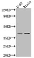 Western Blot; Positive WB detected in: U-87 whole cell lysate, Rat Brain whole cell lysate; All lanes: NGF antibody at 1:1000; Secondary; Goat polyclonal to rabbit IgG at 1/50000 dilution; Predicted band size: 27 kDa; Observed band size: 39 kDa;