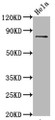 Western Blot; Positive WB detected in Hela whole cell lysate; All lanes Phospho-MAPT antibody at 0.67µg/ml; Secondary; Goat polyclonal to rabbit IgG at 1/50000 dilution; Predicted band size: 80 KDa; Observed band size: 80 KDa;