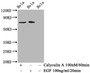 Western Blot; Positive WB detected in Hela whole cell lysate(treated with Calyculin A or EGF); All lanes Phospho-RAF1 antibody at 1.525µg/ml; Secondary; Goat polyclonal to rabbit IgG at 1/50000 dilution; Predicted band size: 73 KDa; Observed band size: 73 KDa;