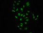 Immunofluorescence staining of HepG2 cells(treated with 50mM Calyculin A for 30min) with CAC10225 at 1:100,counter-stained with DAPI. The cells were fixed in 4% formaldehyde, permeabilized using 0.2% Triton X-100 and blocked in 10% normal Goat Serum. The cells were then incubated with the antibody overnight at 4?. The secondary antibody was Alexa Fluor 488-congugated AffiniPure Goat Anti-Rabbit IgG (H+L).