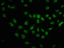 Immunofluorescence staining of Hela cells with CAC10226 at 1:100,counter-stained with DAPI. The cells were fixed in 4% formaldehyde, permeabilized using 0.2% Triton X-100 and blocked in 10% normal Goat Serum. The cells were then incubated with the antibody overnight at 4?. The secondary antibody was Alexa Fluor 488-congugated AffiniPure Goat Anti-Rabbit IgG (H+L).