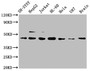 Western Blot; Positive WB detected in: SH-SY5Y whole cell lysate, HepG2 whole cell lysate, Jurkat whole cell lysate, HL-60 whole cell lysate, Hela whole cell lysate, U87 whole cell lysate, Mouse brain tissue; All lanes: CCR9 antibody at 1µg/ml; Secondary; Goat polyclonal to rabbit IgG at 1/50000 dilution; Predicted band size: 43, 41 KDa; Observed band size: 43 KDa;