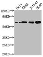 Western Blot; Positive WB detected in: Hela whole cell lysate, K562 whole cell lysate, Jurkat whole cell lysate, HL60 whole cell lysate; All lanes: HDAC1 antibody at 1:2000; Secondary; Goat polyclonal to rabbit IgG at 1/50000 dilution; Predicted band size: 56 kDa; Observed band size: 60 kDa;