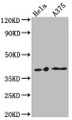 Western Blot; Positive WB detected in: Hela whole cell lysate, A375 whole cell lysate; All lanes: EDG2 antibody at 1:1000; Secondary; Goat polyclonal to rabbit IgG at 1/50000 dilution; Predicted band size: 42, 42 kDa; Observed band size: 42 kDa;