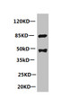 All lanes: Mouse anti-human Platelet-activating factor acetylhydrolase monoclonal Antibody at 1ug/ml; Lane 1:mouse spleen tissue; Secondary:HRP labeled Goat polyclonal to Mouse IgG at 1/3000 dilution; Predicted band size : 48kd; Observed band size : 44kd; Additional bands at: 85kd;