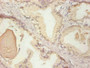 Immunohistochemical of paraffin-embedded human prostate tissue using CAC10263 at dilution of 1:200