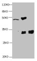 All lanes:Mouse anti-Human Cyfra21-1(KS19.1) monoclonal antibody at 4ug/ml; Lane 1: MCF7 cell lysate; Lane2: MDA-MB-231 cell lysate; Lane3: HepG-2 cell lysate; Secondary HRP labeled Goat polyclonal to Mouse IgG at 1/3000 dilution; Predicted band size : 30 kDa; Observed band size : 32 kDa; Additional bands at: 50kd;