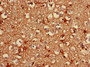 Immunohistochemistry of paraffin-embedded human brain tissue using CAC10269 at dilution of 1:100