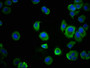 Immunofluorescence staining of MCF-7 cells with CAC10270 at 1:100, counter-stained with DAPI. The cells were blocked in 10% normal Goat Serum and then incubated with the primary antibody overnight at 4°C. The secondary antibody was Alexa Fluor 488-congugated AffiniPure Goat Anti-Mouse IgG(H+L).