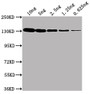 Western Blot; ,Positive WB detected in Recombinant protein (10ng, 5ng, 2.5ng, 1.25ng, 0.625ng); ,All lanes: lacZ antibody at 1:2000; ,Secondary; ,Goat polyclonal to Mouse IgG at 1/50000 dilution; ,Predicted band size: 117 kDa; ,Observed band size: 130 kDa;